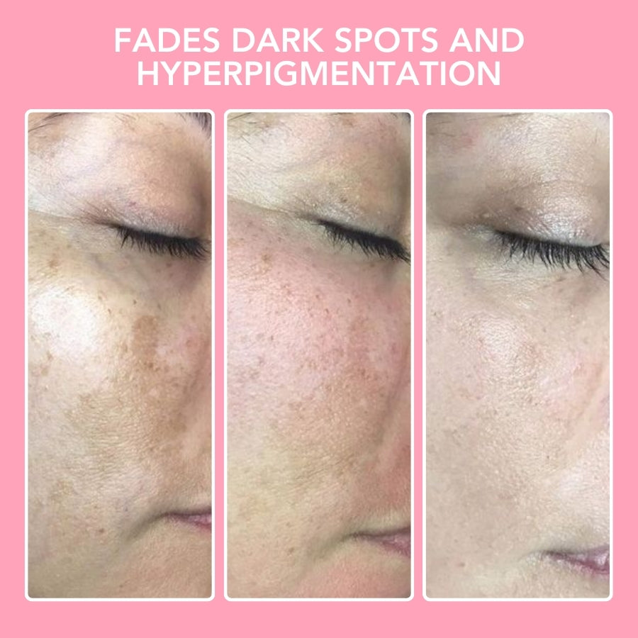 Turmeric & Kojic Acid Cleansing Pads