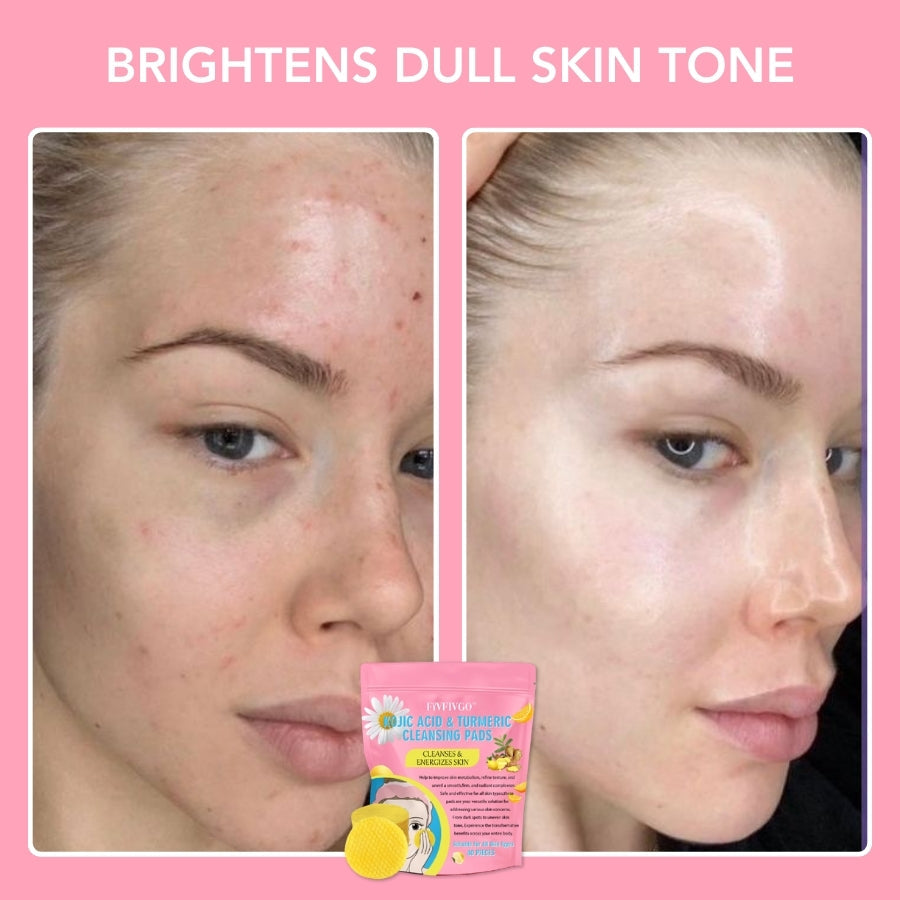 Turmeric & Kojic Acid Cleansing Pads
