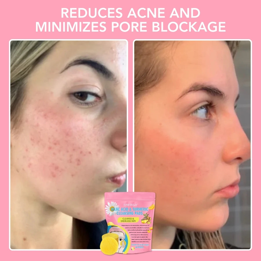 Turmeric & Kojic Acid Cleansing Pads